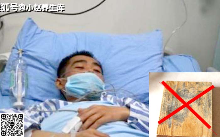 Dùng thớt gỗ 10 năm không thay, 2 cha con bị ung thư gan. Bác sĩ nói gì?